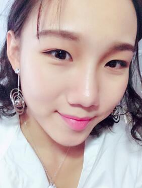 玻尿酸隆鼻術(shù)后2周鼻子算是完全恢復(fù)了