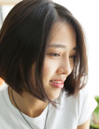 割雙眼皮+開眼角+隆鼻整形