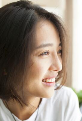 割雙眼皮+開眼角+隆鼻整形