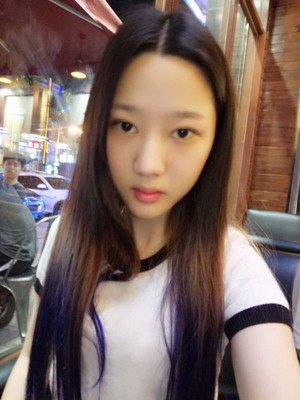 切開雙眼皮+假體隆下巴，我不再是典型的路人甲