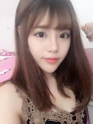 耳軟骨墊鼻尖+硅膠假體隆鼻前后對比，變化是不是很大