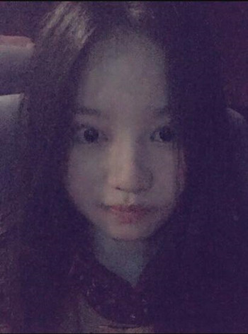 我的隆鼻整形恢復(fù)時(shí)的那些事