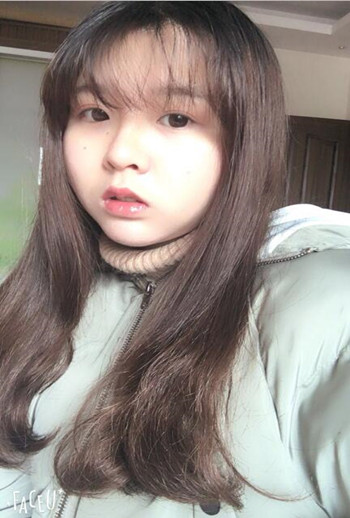 我的頰脂肪墊切除+假體墊下巴整形恢復(fù)果心情日記