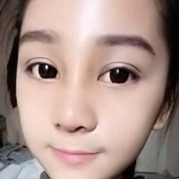隆鼻整形恢復(fù)日記分享，整形價(jià)格8800元