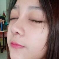 隆鼻整形恢復(fù)日記分享，整形價(jià)格8800元