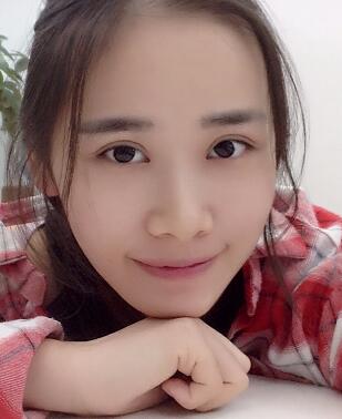 割雙眼皮一個半月了,雙眼皮完全恢復(fù)自然