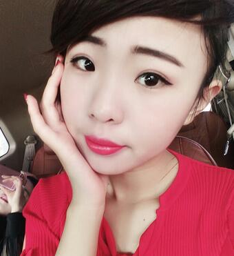 割雙眼皮術(shù)后恢復(fù)過程 全切雙眼皮3個(gè)月