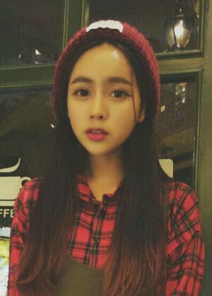 自體脂肪豐額頭+蘋(píng)果肌恢復(fù)兩個(gè)月照片分享