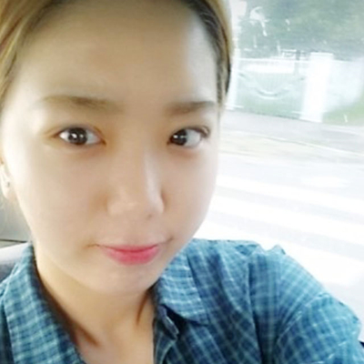 埋線雙眼皮手術(shù)兩個月了，分享術(shù)后恢復(fù)的照片呢~