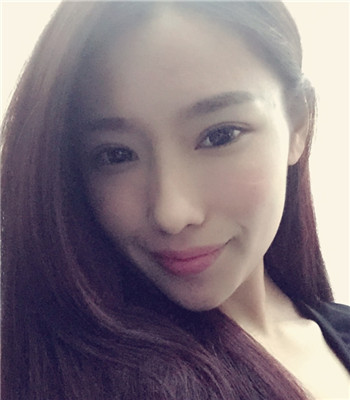 注射瘦臉注射瘦臉咬肌不見了