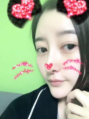 硅膠隆鼻+去眼袋前后對(duì)比果十分明X