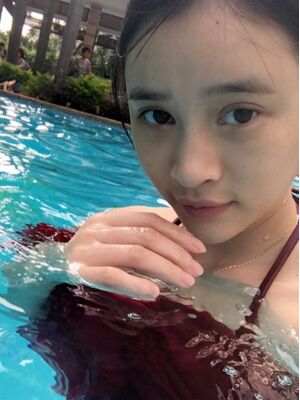 雙眼皮失敗修復(fù)之后疤痕完全沒有啦