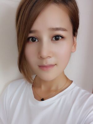 隆鼻和雙眼皮修復(fù)一起做的，現(xiàn)在氣質(zhì)提升好多