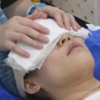 去眼袋手術(shù)多少錢？做了激光去眼袋價格5800元，恢復(fù)很好