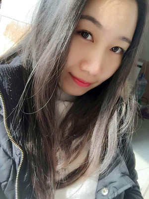 自體脂肪豐面頰，見證我蝶變的過程