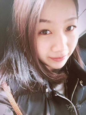 自體脂肪豐面頰，見證我蝶變的過程