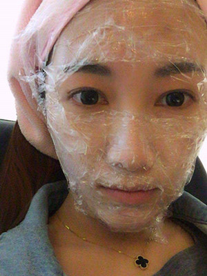 光子嫩膚真實(shí)案例分享，果真的還不錯(cuò)哦!