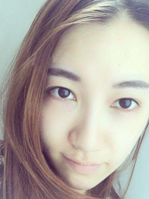 光子嫩膚真實(shí)案例分享，果真的還不錯(cuò)哦!