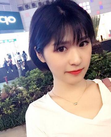 微創(chuàng)定點(diǎn)每天恢復(fù)過(guò)程圖 北京麗星雙眼皮3個(gè)月