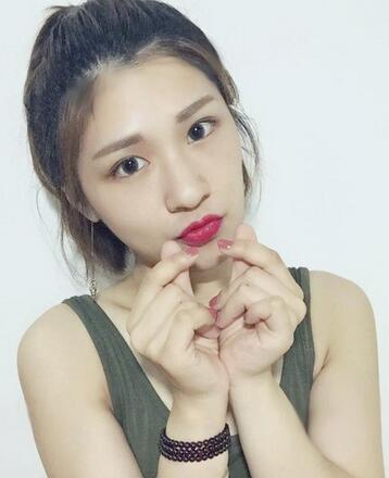 微創(chuàng)定點(diǎn)每天恢復(fù)過(guò)程圖 北京麗星雙眼皮3個(gè)月