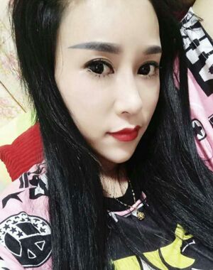 牛永敢做的隆鼻失敗修復(fù)，對(duì)比很明X哦~