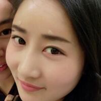 自體脂肪填充太陽穴豐額頭親身經歷，多過程恢復圖分享