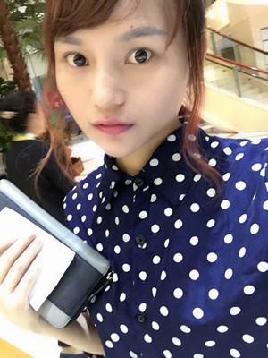 瓜子臉改臉型手術(shù)前后變化大對比