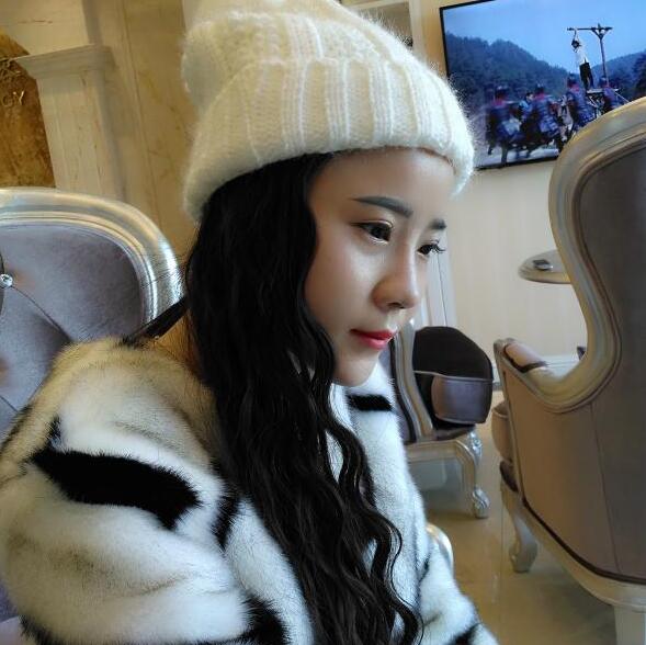 隆鼻整形前后恢復(fù)過程隆鼻梁+墊鼻尖整形果很好哦