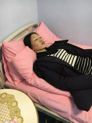 開眼角+割雙眼皮手術(shù)前后過程圖分享