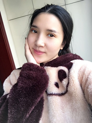 開眼角+割雙眼皮手術(shù)前后過程圖分享