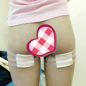 大腿吸脂，我也可以擁有小細(xì)腿