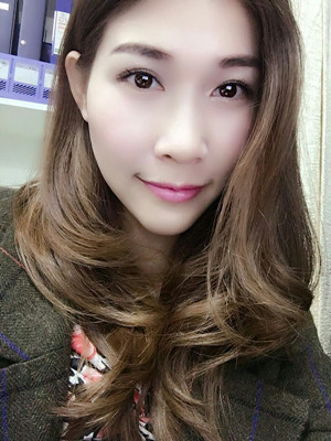 激光祛眼袋2個(gè)月，不用手術(shù)就可以變得很年輕哦！