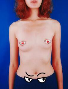 曼托假體隆胸前正面圖片