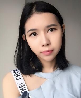 自體脂肪填充恢復(fù)日志 自體脂肪填充太陽穴+額頭