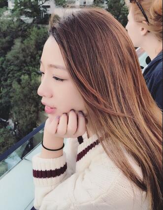 硅膠隆鼻恢復日記 硅膠隆鼻+鼻小柱延長+墊鼻尖