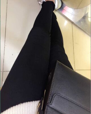 大腿抽脂的過程照片，瘦了一大圈呢