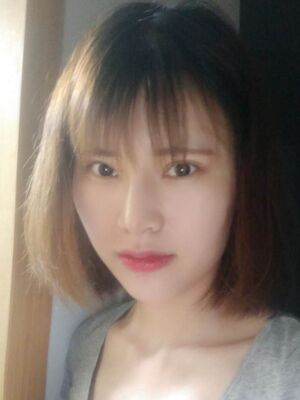 隆鼻整形真實恢復(fù)期圖片，大鼻子終于變秀氣了