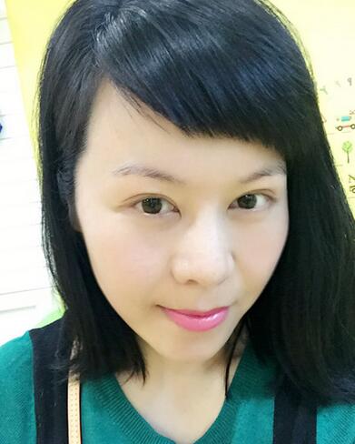 面部埋埋蛋白線.提升恢復(fù)過程分享