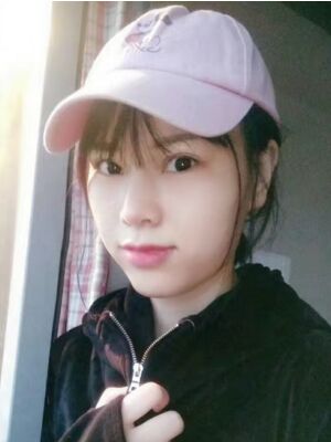 隆鼻整形真實恢復(fù)期圖片，大鼻子終于變秀氣了