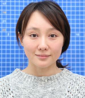 面部埋埋蛋白線.提升手術(shù)前照片