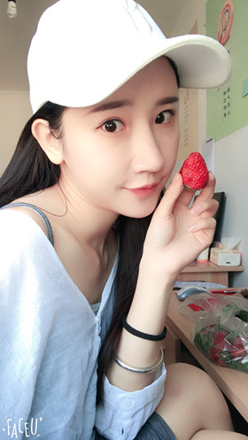 56000元做的自體脂肪填充蘋果肌+太陽穴，大家來看看果怎么樣