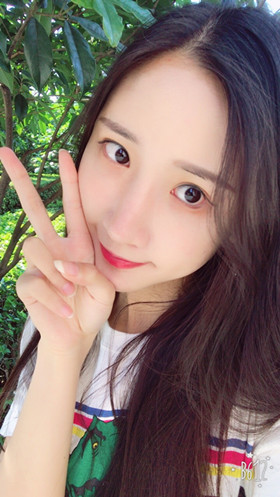 56000元做的自體脂肪填充蘋果肌+太陽穴，大家來看看果怎么樣