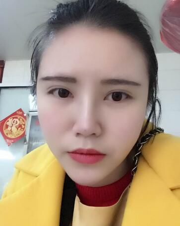 耳軟骨墊鼻尖一個(gè)月圖