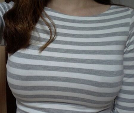 假體隆胸多久能恢復(fù)，親測(cè)兩個(gè)月吧