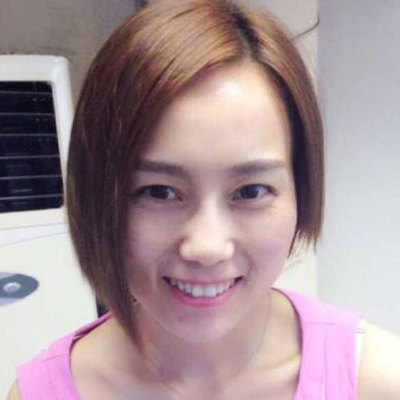 上海九院戴傳昌玻尿酸注射隆鼻和墊下巴案例