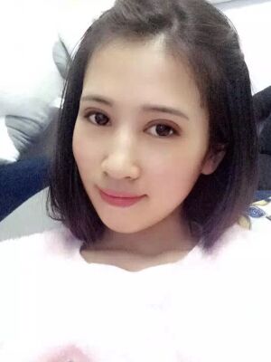 切開雙眼皮恢復(fù)過程，手術(shù)很成功哦