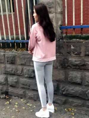 大腿吸脂果超好，腿型好看很多了