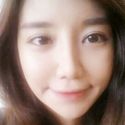 攀枝花奇麗陳光利注射瘦臉+玻尿酸隆鼻案例