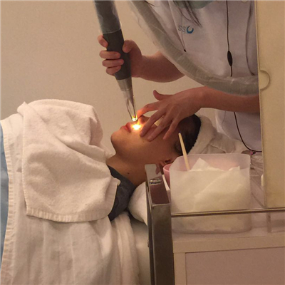 杭州格萊美徐云喜激光去黃褐斑案例