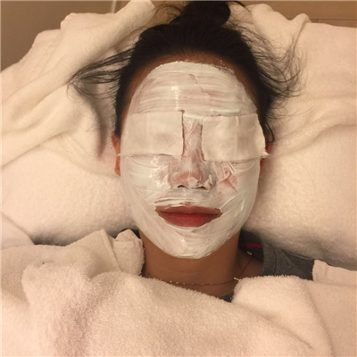 杭州格萊美徐云喜激光去黃褐斑案例